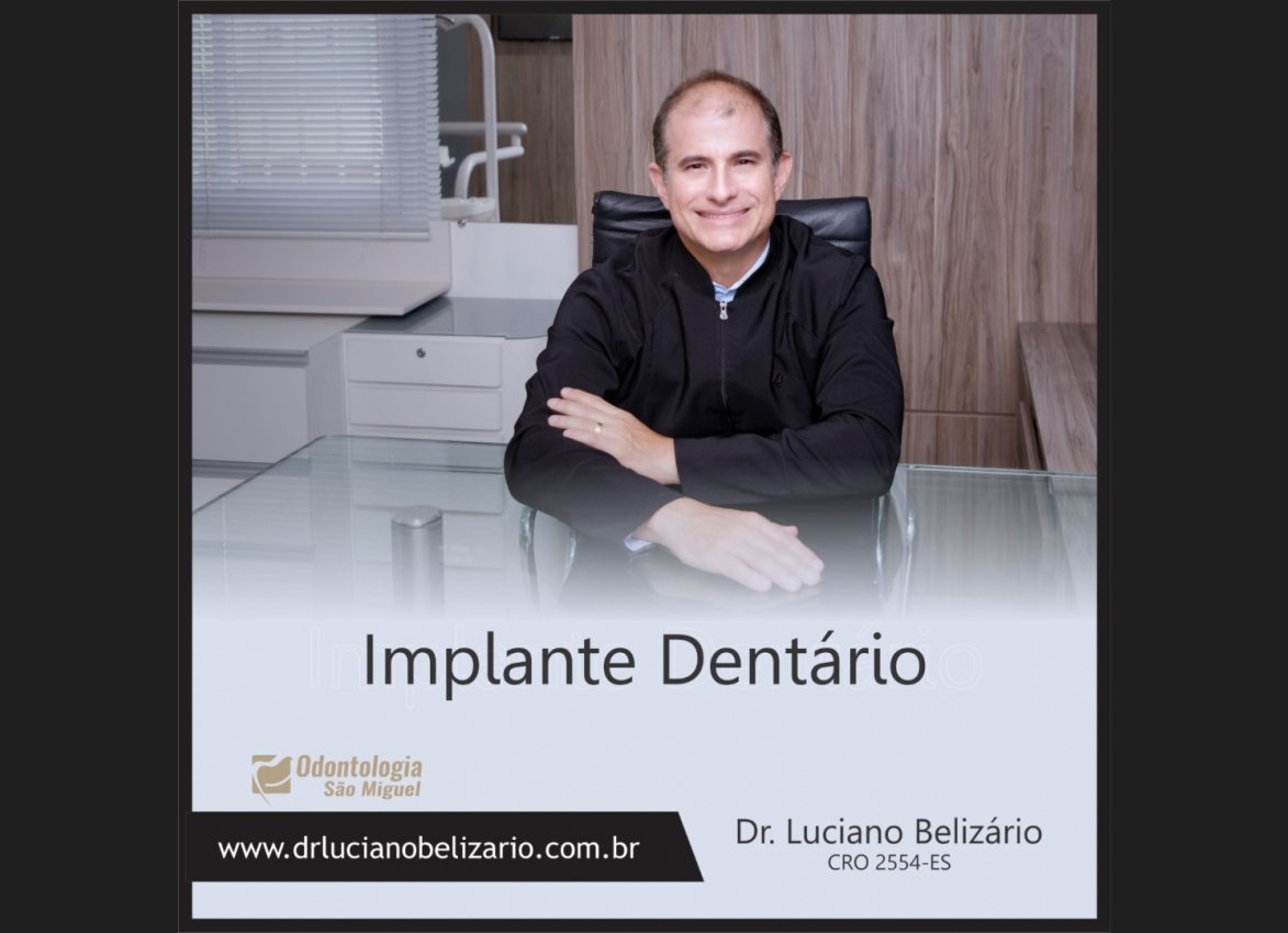 Implante Dentário Blog Dr. Luciano Belizário
