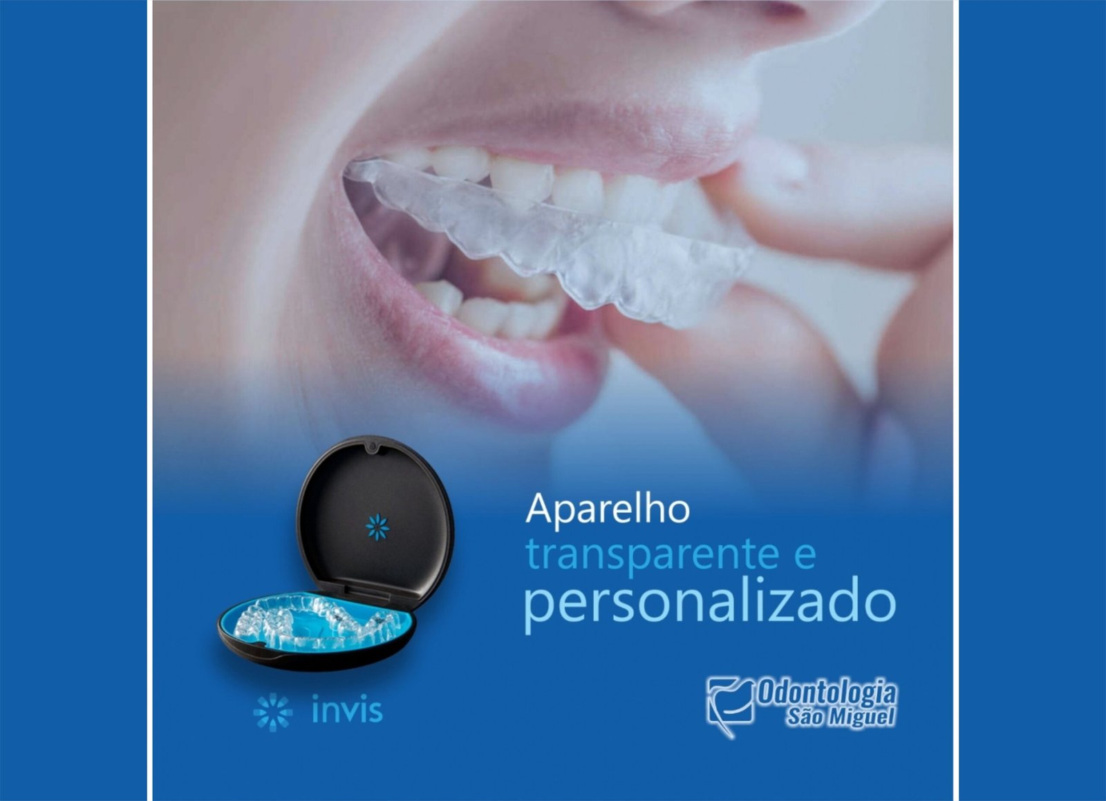 Aparelho transparente e personalizado Blog Odontologia São Miguel
