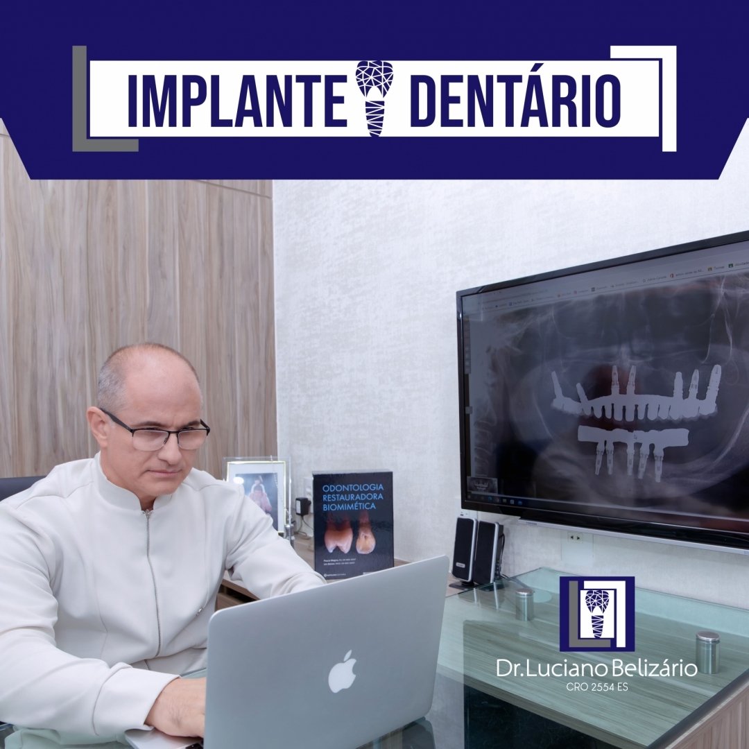 odontologia.saomiguel_346459946_240807205160482_1874512643458021377_n